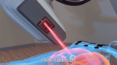 精准技术创新，让放疗不再可怕