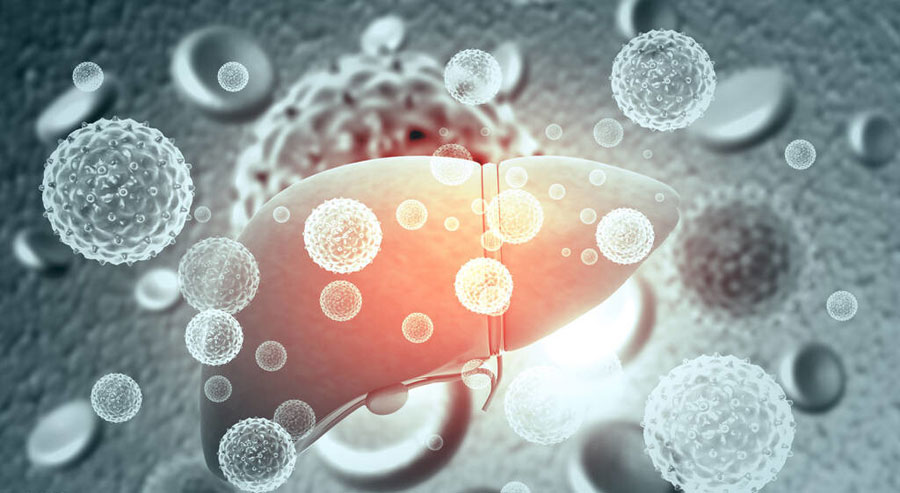 肝硬化会变成肝癌?肿瘤专家提醒:这4个因素需警惕,做好预防是关键